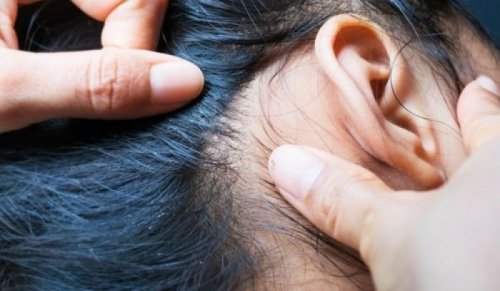 Въшки плъзнаха в пловдивски училища: Родители сигнализират за клас с масово заразяване